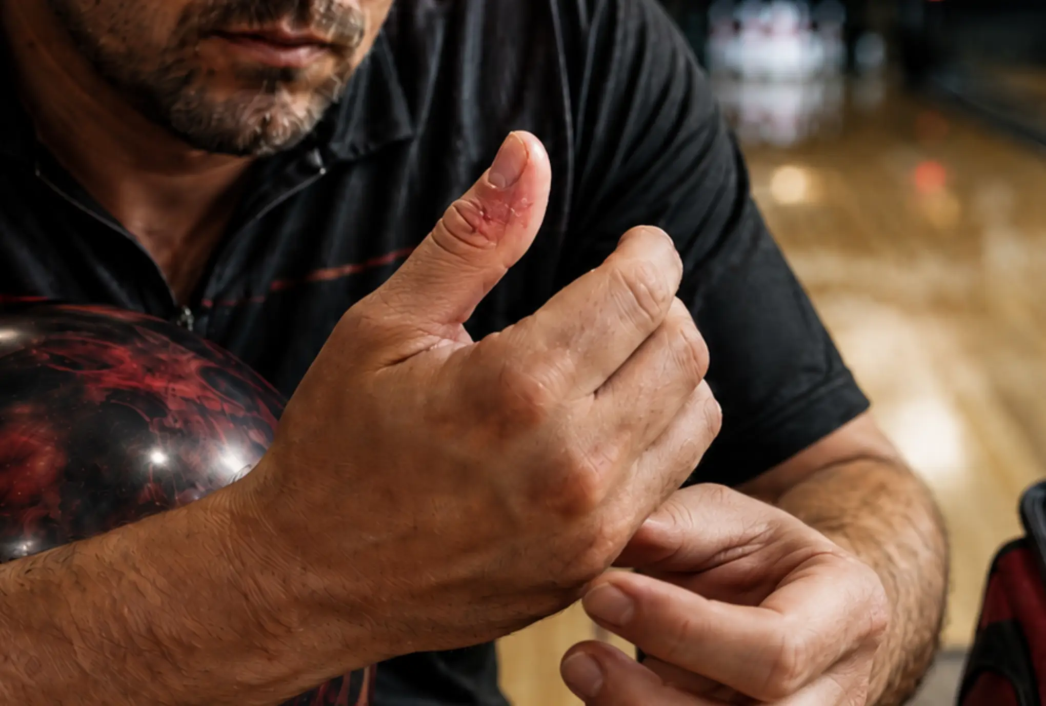 Bowling Skin Rips: The Bloody Side Every Bowler Hates